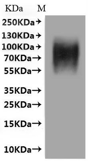 Recombinant Human Beta-2 adrenergic receptor (ADRB2) (G16R,E27Q)-VLPs (CSB-MP001392HU(M))