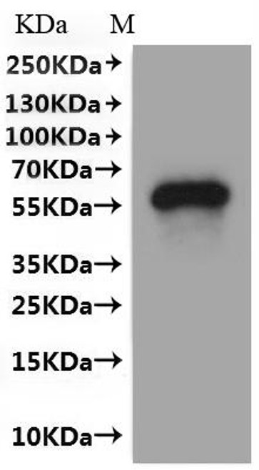 Recombinant Human Transmembrane 9 superfamily member 1 (TM9SF1)-VLPs (CSB-MP023626HU(A4))