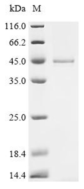 Recombinant Human Guanine nucleotide-binding protein G(k) subunit alpha (GNAI3) (CSB-BP009591HU(A4)) Recombinant Human Guanine nucleotide-binding protein G(k) subunit alpha (GNAI3) (CSB-BP009591HU(A4))