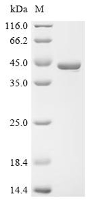 Recombinant Dickeya chrysanthemi L-asparaginase (ansB) (CSB-EP002233EGI)