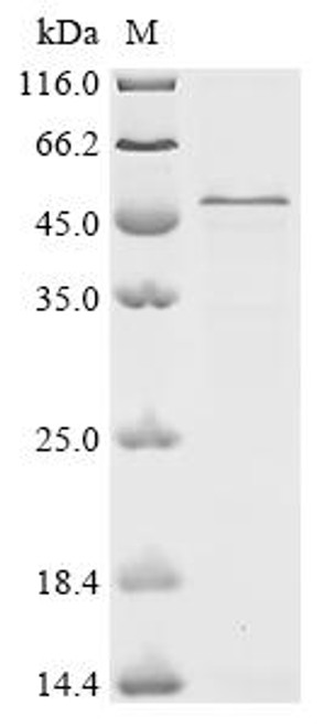 Recombinant Mouse CD5 antigen-like (Cd5l) (CSB-EP874099MO)