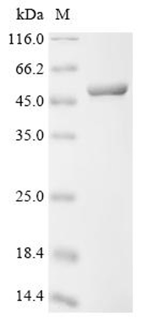 Recombinant Human Phosphoglycerate kinase 1 (PGK1) (CSB-EP017856HU)