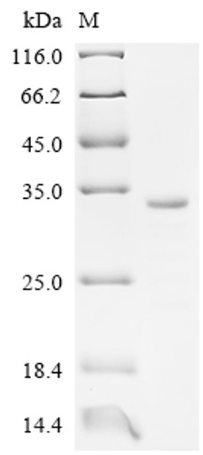 Recombinant Human Butyrophilin-like protein 2 (BTNL2), partial (CSB-EP883443HU8)