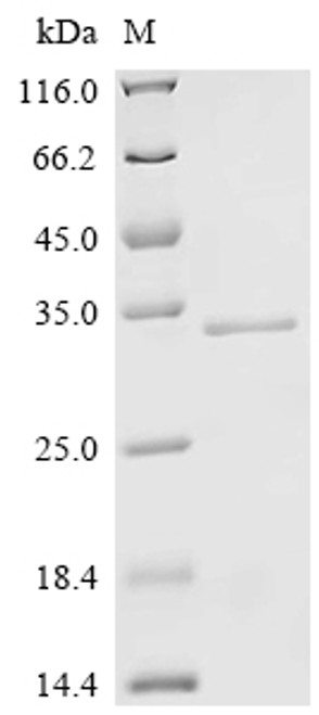 Recombinant Human Collagen alpha-1 (XXI) chain (COL21A1), Partial (CSB-EP836273HU)