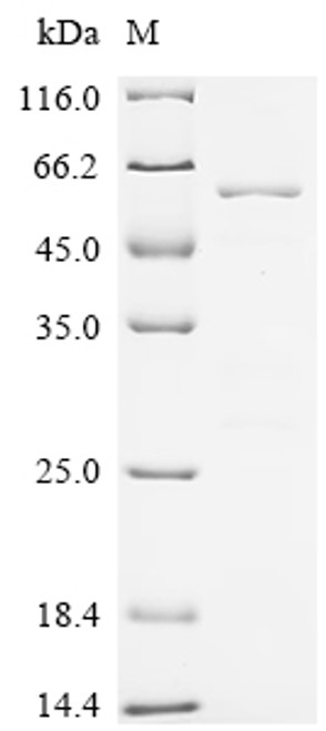 Recombinant Human Serine/threonine-protein phosphatase PGAM5,mitochondrial (PGAM5), partial (CSB-EP839338HU)