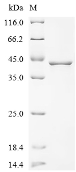 Recombinant Human L-lactate dehydrogenase A chain (LDHA) (CSB-EP012832HU)