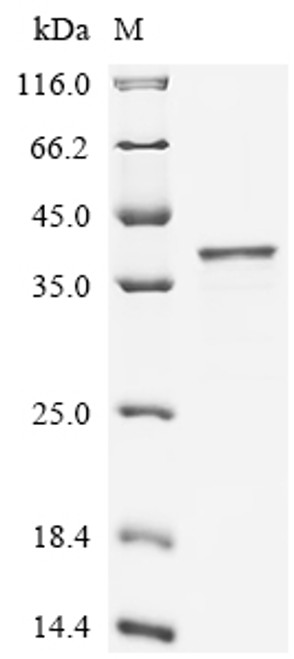 Recombinant Human Serine/threonine-protein phosphatase PGAM5,mitochondrial (PGAM5), partial (CSB-EP839338HUc7)