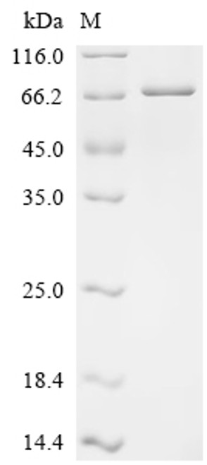 Recombinant Human Ubiquitin carboxyl-terminal hydrolase 43 (USP43) , Partial (CSB-EP758219HU)