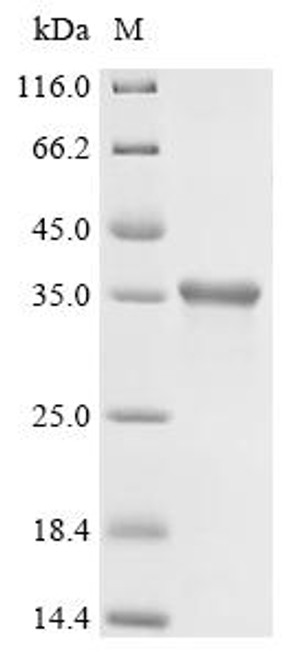 Recombinant Feline coronavirus Spike glycoprotein (S), Partial (CSB-EP319859FEJ1)