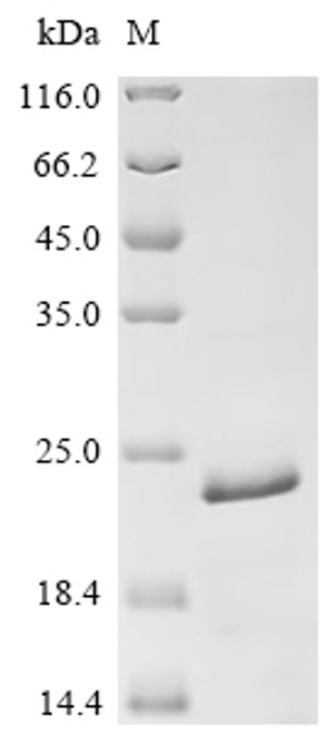 Recombinant Human herpesvirus 6A Large structural phosphoprotein (U11), partial (CSB-EP312412HJZ)