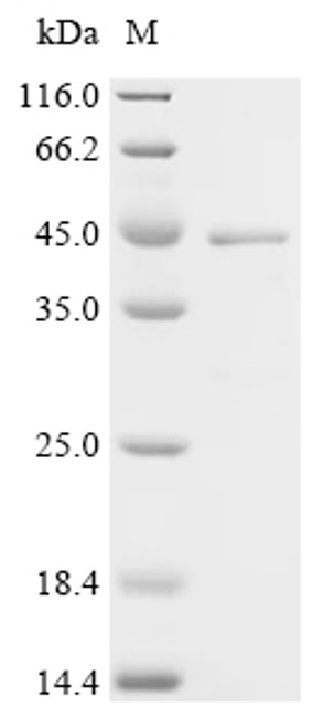 Recombinant Feline coronavirus Spike glycoprotein (S), Partial (CSB-EP319859FEJ1a2)