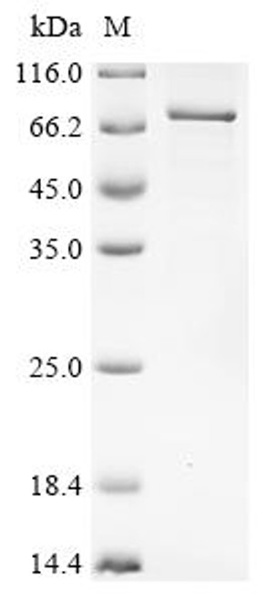 Recombinant Human Paired box protein Pax-7(PAX7) (CSB-EP017493HU)