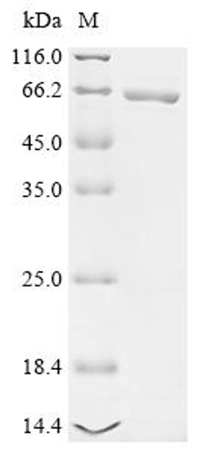 Recombinant Clostridioides difficile Toxin B (toxB), partial (CSB-EP321589DUN1)