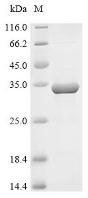Recombinant Human Signal-induced proliferation-associated 1-like protein 2 (SIPA1L2), partial (CSB-EP882179HU)