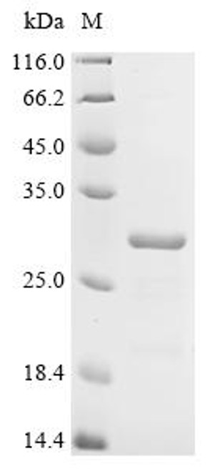 Recombinant Human E3 ubiquitin-protein ligase RNF43 (RNF43), partial (CSB-EP019892HU)