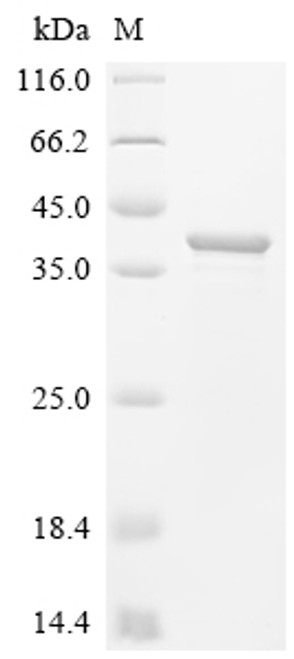 Recombinant Thermotoga maritima Pseudouridine-5'-phosphate glycosidase (psuG) (CSB-EP895816TNJ)