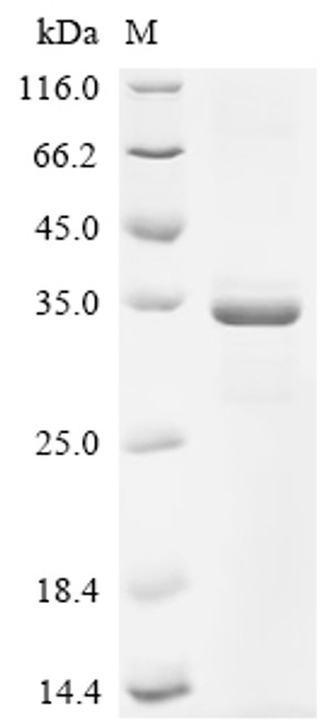 Recombinant Human 28S ribosomal protein S21, mitochondrial (MRPS21) (CSB-EP014898HU)