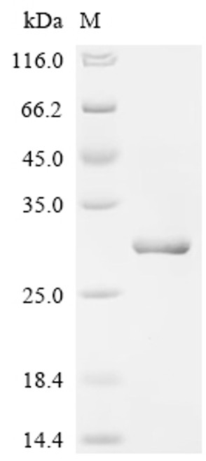 Recombinant Human Telomerase-binding protein EST1A (SMG6), partial (CSB-EP773032HU)