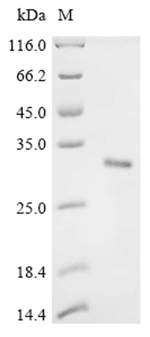 Recombinant Mouse Collagen alpha-1 (XI) chain (Col11a1), partial (CSB-EP736811MOa2)