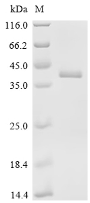 Recombinant HumanKelch-like ECH-associated protein 1 (KEAP1), partial (CSB-EP012147HU1)