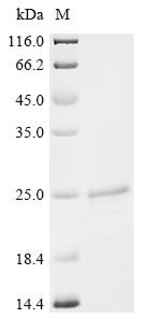 Recombinant Haemophilus influenzae Peptidoglycan-associated lipoprotein (pal) (CSB-EP319884HTA)