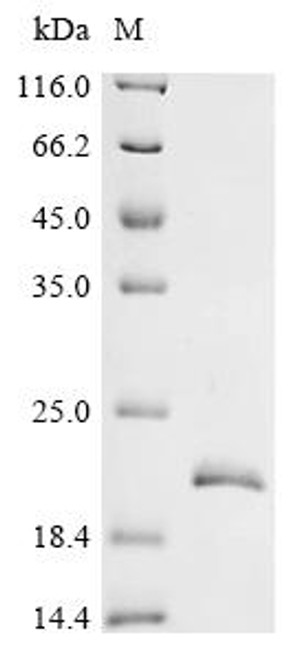 Recombinant Mouse Cystatin-14 (Cst14) (CSB-EP851863MO)