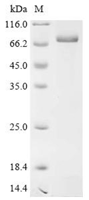 Recombinant Rat Alpha-fetoprotein (Afp) (CSB-EP001421RA)