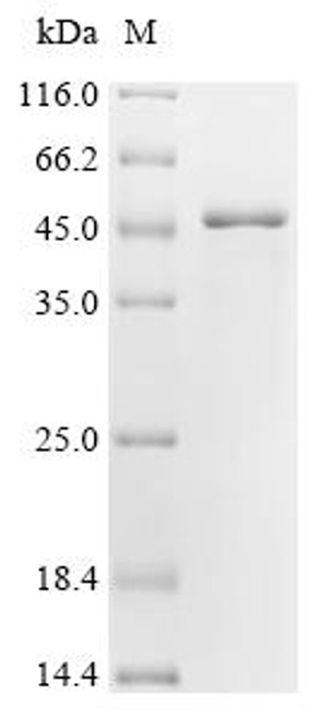 Recombinant Human Vascular endothelial growth factor A (VEGFA), partial (CSB-EP025833HU1)