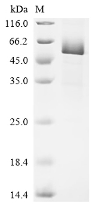 Recombinant Mouse Interleukin-1 receptor-like 2 (Il1rl2), partial (CSB-EP875357MOa2)