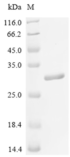 Recombinant Rat Parathyroid hormone/parathyroid hormone-related peptide receptor (Pth1r), partial (CSB-EP018988RA2)
