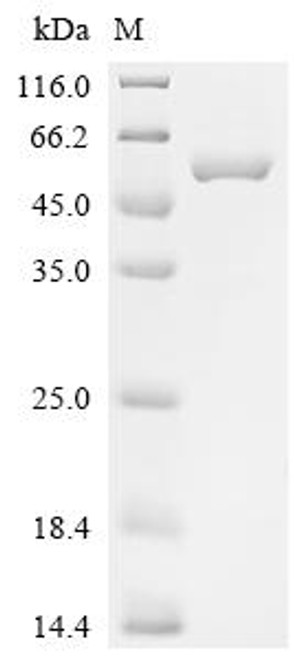 Recombinant Saccharomyces cerevisiae D-serine dehydratase (DSD1) (CSB-EP346044SVG)
