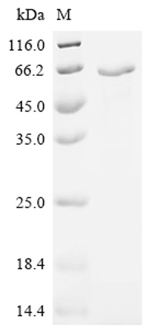 Recombinant Sendai virus Hemagglutinin-neuraminidase (HN), partial (CSB-EP361050SEZ1)