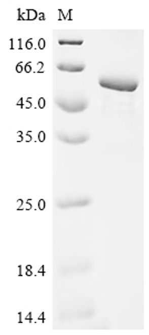 Recombinant Human Methyltransferase-like protein 17, mitochondrial (METTL17) (CSB-EP880990HUa0)