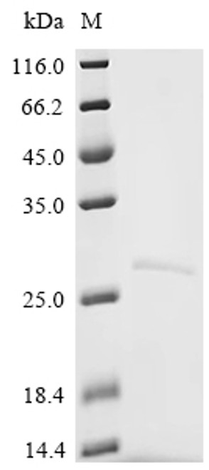 Recombinant Human Low affinity immunoglobulin gamma Fc region receptor II-a (FCGR2A), partial (CSB-EP008540HU1)