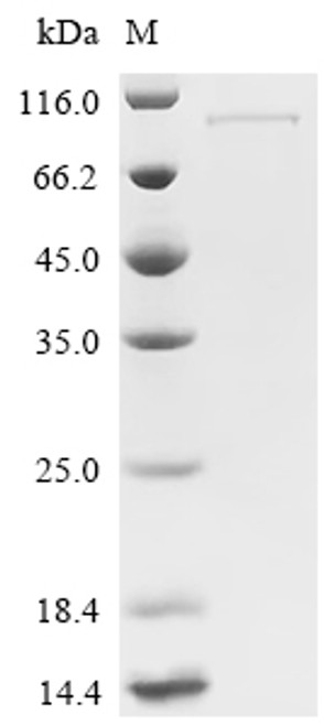 Recombinant Human Wee1-like protein kinase (WEE1) (CSB-EP026084HUc7)