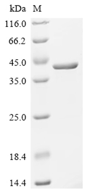 Recombinant Human Delta (3,5)-Delta (2,4)-dienoyl-CoA isomerase, mitochondrial (ECH1) (CSB-EP621643HU)