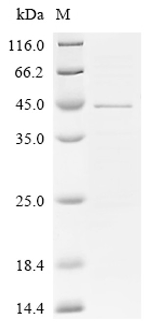 Recombinant Human UDP-GlcNAc:betaGal beta-1,3-N-acetylglucosaminyltransferase 5 (B3GNT5), partial (CSB-EP002503HU)