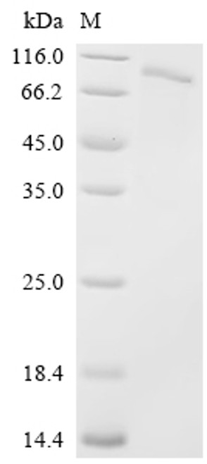 Recombinant Crimean-Congo hemorrhagic fever virus Envelopment polyprotein (GP), partial (CSB-EP810349CSC2)