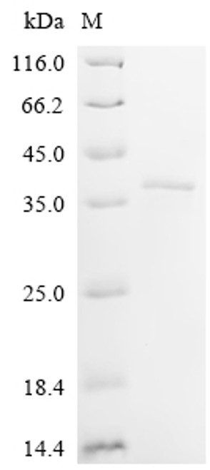 Recombinant Mouse Coiled-coil domain-containing protein 3 (Ccdc3) (CSB-EP861555MOb1)