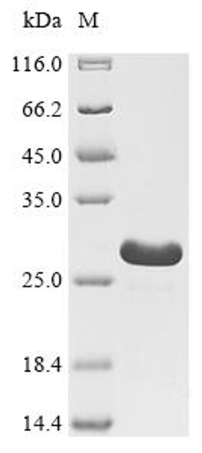 Recombinant African swine fever virus Inner membrane protein p54 (p54), partial (CSB-EP5531GOGc7)