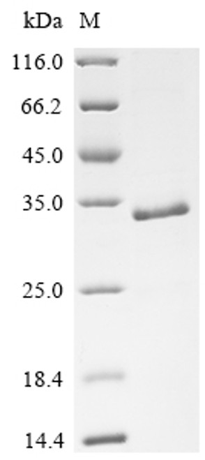 Recombinant Human Protein Wnt-5a (WNT5A), partial (CSB-EP026138HU1c7)