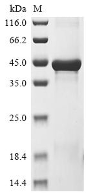 Recombinant Human Nucleoporin NUP35 (NUP35) (CSB-EP836735HU)