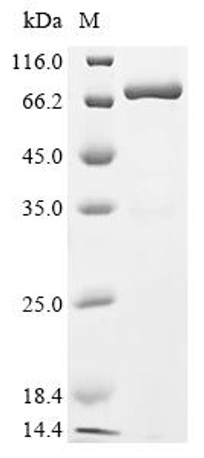 Recombinant Mouse Cell surface glycoprotein CD200 receptor 1 (Cd200r1), partial, Biotinylated (CSB-EP863669MO-B)