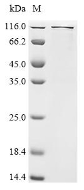 Recombinant Mouse Transcription regulator protein BACH1 (Bach1), Biotinylated (CSB-EP002526MO-B)