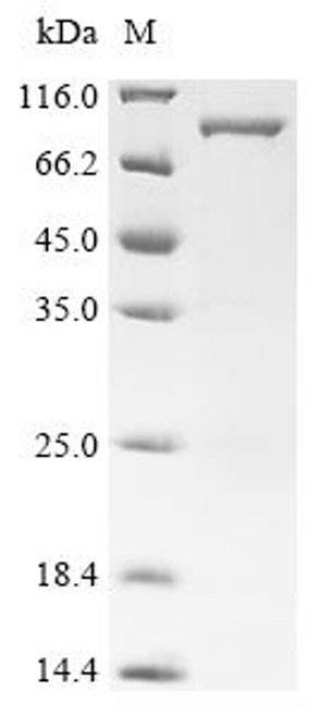 Recombinant Human Peroxisome prolifeRator-activated receptor gamma (PPARG) (CSB-EP018424HUf0)