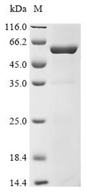 Recombinant Human Protein cereblon (CRBN), partial, Biotinylated (CSB-EP842761HU1-B)