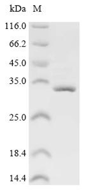 Recombinant Escherichia coli K88 fimbrial protein AC (faeG) (CSB-EP320337ENL)