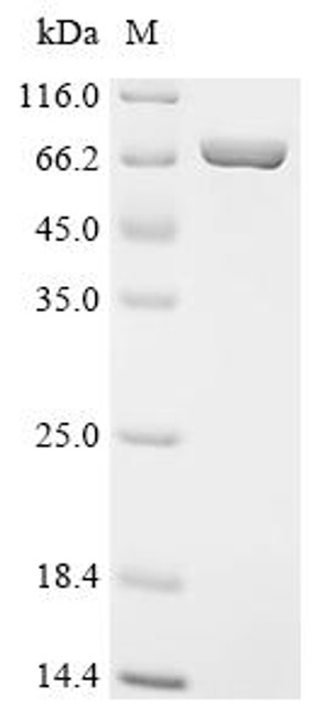 Recombinant Human Apoptosis-associated speck-like protein containing a CARD (PYCARD), Biotinylated (CSB-EP890936HU-B)