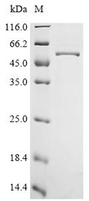 Recombinant Human Heparan-sulfate 6-O-sulfotransferase 1 (HS6ST1), partial (CSB-EP010756HU1)