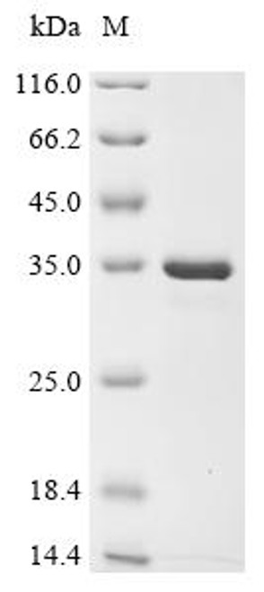 Recombinant Human Beta-crystallin B3 (CRYBB3) (CSB-EP006015HU)
